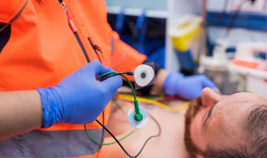Avoiding ECG Electrode Shortages
